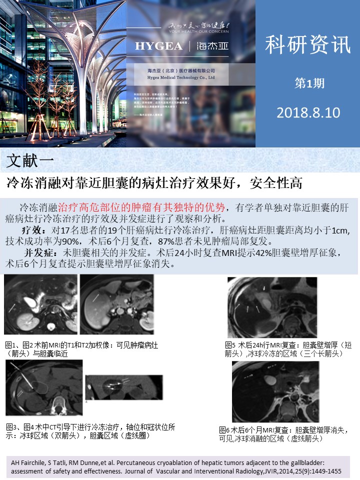 【海杰亞科研資訊】第1期——肝、肺癌消融
